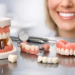 Best Options for Missing Teeth for Your Smile