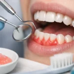Encías inflamadas: tratamiento y causas