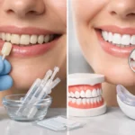 Best Treatments for Stained Teeth That Work