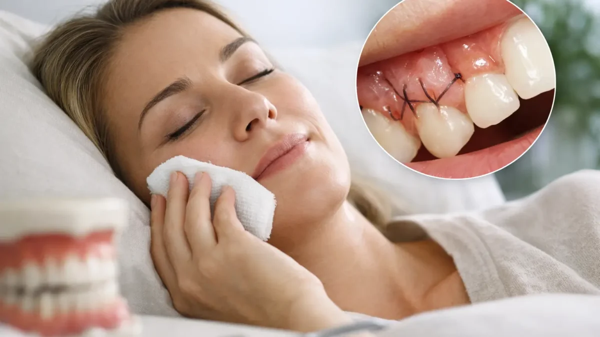 Recuperacion tras cirugia periodontal: Healing